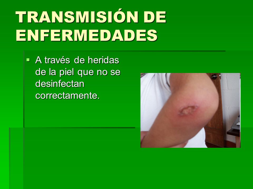 Las máscaras para la persona de la glicerina de las arrugas